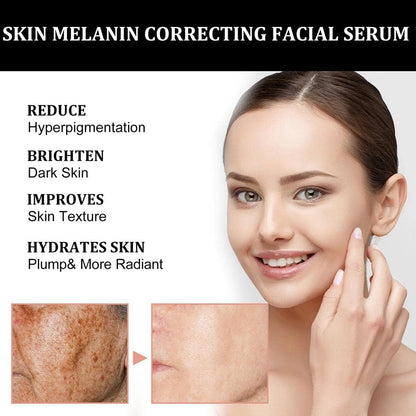 Vivilexio™ Melanin Corrector Serum (Pack of 2)